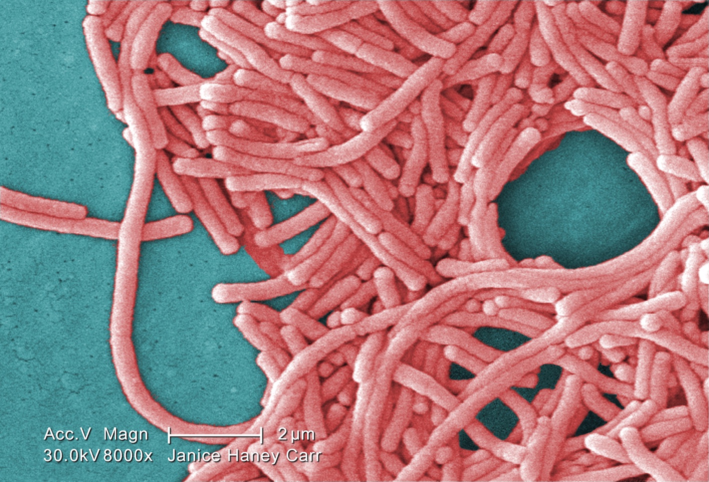 Gram-negative Legionella pneumophila bacteria (Janice Haney Carr, CDC)