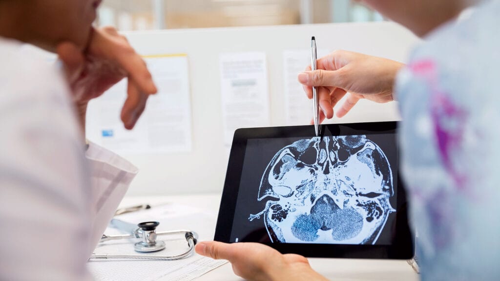 New access to less costly, specialized dementia CT scan diagnostics found