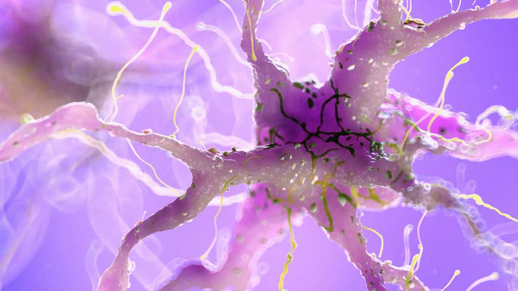 damaged amyloid plaque in brain cells image