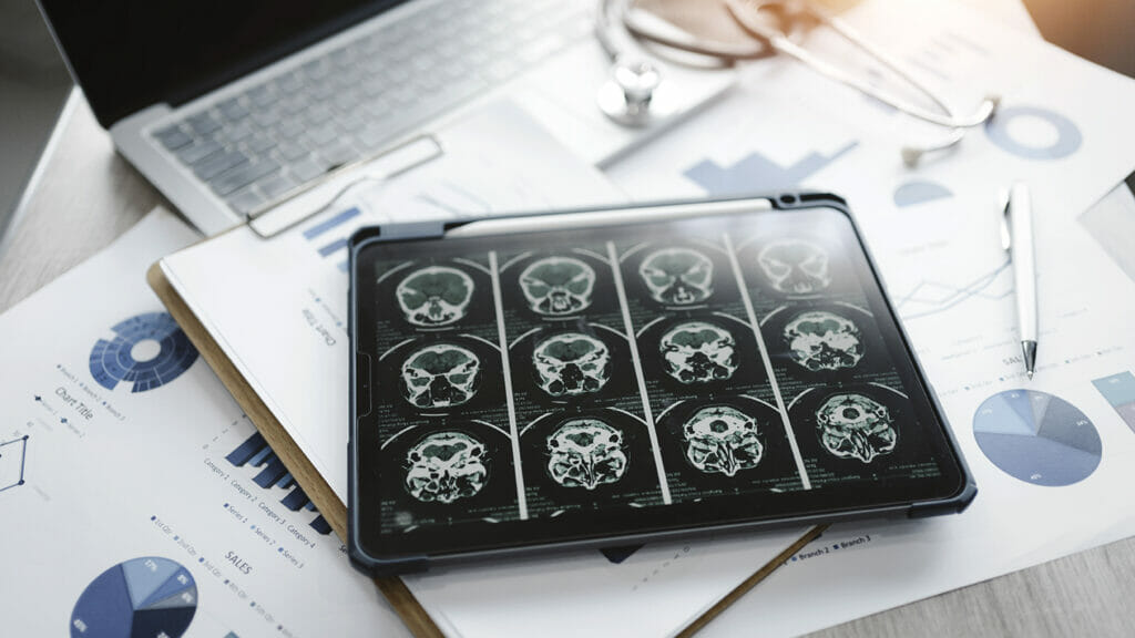 Close-up of a digital tablet with brain x-ray on screen.