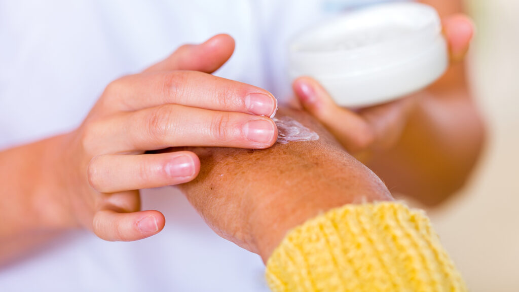 Caregiver rubbing an elderly woman's hand with cream.