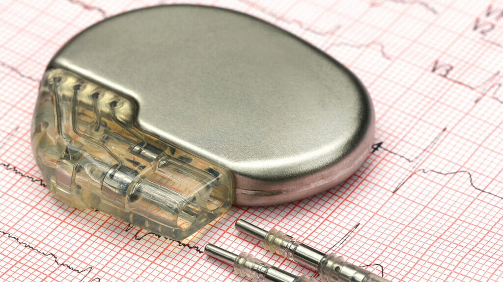 Clinicians and caregivers must keep pace with new pacemaker tech available for seniors: study