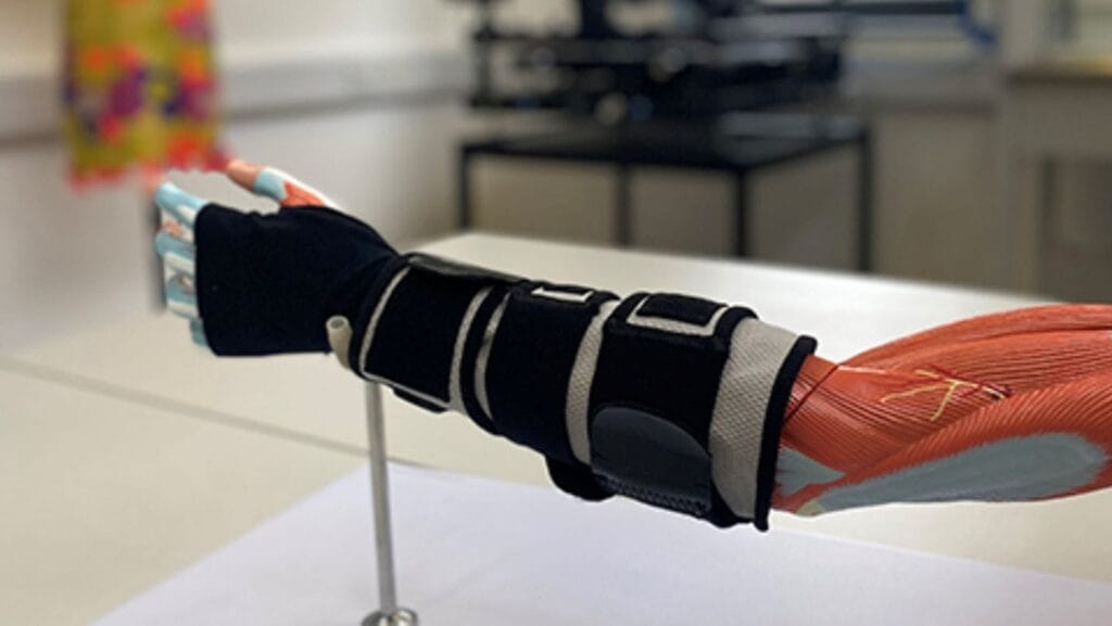 New stroke rehab glove helps arm seniors with tool for recovering limb use