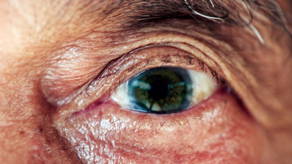 Let there be light! Eye-phototherapy device for Parkinson’s is released after long development delay